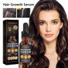 Allurium Beauty Hair Growth Serum for Black Women, Allurium Hair Growth Serum for Black Women, for Thicker Longer Fuller Healthier Hair, Prevent Hair Loss & Thinning (2pc) view 2