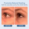 twenty/twenty Easy On The Eyes  0.02% Hypochlorous Acid Spray to Cleanse Eyelashes  Reduce Eyelid Irritation  Safe for Sensitive Skin  Ophthalmologist DevelopedVegan, Clean Ingredients  60ml view 4