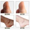 Yellow Peeling Oil for Exfoliating, Whitening, Softening, Callus Removal, Dark Skin, Cutin, Callus Skin view 4