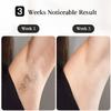 JOVS Laser Hair Removal, [24J Energy] IPL Hair Removal for Women and Men, 37F Painless Sapphire Ice-Cooling Tech, 6 Modes for Whole Body Hair Removal Device, 2 in 1 Skin Rejuvenation, 330 Rotation view 4