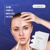 Pimple Patch Acne Patches Facial Skin Care Products, Blackhead Remover Skincare, Pimple Patch for Face and Hydrocolloid Acne Treatment Patch Salicylic Acid, Acne Spot Treatment (24 Count (Pack of 1)) view 3