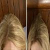 Caboki Value Pack 3, 270-Day Supply, Natural Blonde view 4