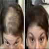 CABOKI VALUE PACK 2 (3 x 30 gram plus one Volume Control Mist), 270-Day Supply, Dark Brown view 3