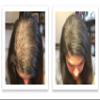 Hide Bald Spots and Bald Edges Instantly. Make Thin Hair Look 10X Fuller. Caboki Hair Fiber Starter Kit (Dark Brown) view 3