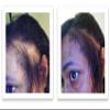 Hide Bald Spots and Bald Edges Instantly. Make Thin Hair Look 10X Fuller. Caboki Hair Fiber Starter Kit (Black) view 4