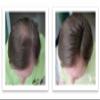 Hide Bald Spots and Bald Edges Instantly. Make Thin Hair Look 10X Fuller. Caboki Hair Fiber Starter Kit (Medium Brown) view 3