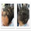 CABOKI VALUE PACK 1, 2x30G Hair Building Fiber Plus Hair Fiber Spray. 180-Day supply, Salt & Pepper Dark view 3