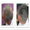 CABOKI VALUE PACK 1, 2x30G Hair Building Fiber Plus Hair Fiber Spray. 180-Day supply, Salt & Pepper Light view 3