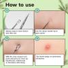 I DEW CARE Dual-Tip Pimple Tool - Proper Popper | Blackhead Remover, Blemish Exfoliating, Professional Acne Squeezer, Comedone Zit Extractor for Women, 2in1 Stainless Steel Lancet, 1ea view 3