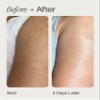 Topicals Slather Exfoliating Body Serum - With Retinol, Squalane, Urea and AHAs for Bumpy, Rough or Textured Skin - AHA Exfoliating Serum for Body (5 Fl Oz) view 4