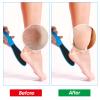 WLLHYF 4 Pieces Double Sided Pedicure Foot File Foot Scraper, Exfoliator Remover Dead Skin Hard Skin Calluses Foot Scrubber Reusable Foot Care Pedicure Tool for Wet and Dry Cracked Feet 2 Sizes view 3
