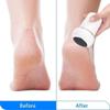 Feiyx Electric Callus Remover Foot File,Remover Callus Removal Pedicure Tools for Feet Calluses,Shaver with Built-in Suction view 3