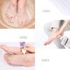JYYBN Foot Grinder, Electric Callus Remover Foot File Portable Foot Pedicure Tools for Cracked Heels, Callus and Hard Dead Sha view 4
