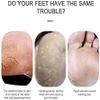 Feiyx Foot Scrubber Electric Foot File,Pedicure Tools Callus,Sander for Cracked Heels and Hard Dead Skin view 3
