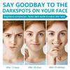 Dark Spot Remover for Face, Fast-Acting Dark Spot Corrector Remover for Face and body Hyperpigmentation, Fades Melasma, Freckle, Sun Spots, Evens Skin Tone, Age Spot Remover for Women Men view 3