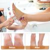 FOMIYES 2pcs Dead Skin Remover Tool for Feet Gentle Rubbing File Handle Easy to Use Pedicure Foot Care Scrub view 2