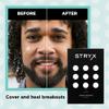 Stryx Hydrocolloid Acne Pimple Patches for Men, 3-Pack - Great for Breakouts, Zits, Blemishes, Whiteheads, & Reducing Redness - Designed for Mens Larger Pores - Ultra-Thin, Invisible Application view 2