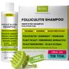 Folliculitis Shampoo | Antifungal Shampoo for Seborrheic Dermatitis, Scalp Psoriasis & Dandruff | Soothes Itchy, Dry Scalp | Cleanses, Exfoliates & Removes Build-Up | Reactivates Hair Follicles view 1