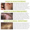Folliculitis Shampoo | Antifungal Shampoo for Seborrheic Dermatitis, Scalp Psoriasis & Dandruff | Soothes Itchy, Dry Scalp | Cleanses, Exfoliates & Removes Build-Up | Reactivates Hair Follicles view 3
