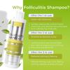 Folliculitis Shampoo | Antifungal Shampoo for Seborrheic Dermatitis, Scalp Psoriasis & Dandruff | Soothes Itchy, Dry Scalp | Cleanses, Exfoliates & Removes Build-Up | Reactivates Hair Follicles view 4