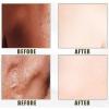 Yellow Peeling Oil, Exfoliation Yellow Peeling Solution Easy To Use for Cutin view 2