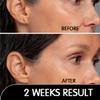 Miracle Stretched earlobe Corrector shrinking oil fix torn and stretched piercing hole no more ear lobe support patches for earrings Miracle Ear Lobe view 3