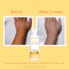 WishCare Sunscreen Body Lotion with SPF 50 PA+++ - Broad Spectrum UVA & UVB Protection, No White Cast, Enriched with Carrot Seed & Raspberry - Body Sunscreen Lotion 200ml view 3