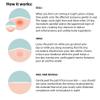 Frilliance Microdart Hydrocolloid Acne Pimple Patches for Zits and Blemishes (4 count) Spot Treatment Stickers for Face & Skin, Vegan and Cruelty Free (Deep Dive Micro Darts) view 3