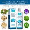 Roycederm Psoriasis Shampoo, Seborrheic Dermatitis Shampoo, Folliculitis Shampoo, Dandruff Shampoo, Scalp Psoriasis & Seborrheic Dermatitis Treatment, Dry Itchy Scalp Treatment view 3