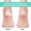 Vaincre Gel Moisturizing Heel Socks for Dry Cracked Feet Women, 4 Pairs Foot Care Spa Moisture Toeless Socks for Cracked Heel Repair Treatment Overnight (Regular) view 2
