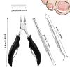 (30+3) Pack Ingrown Toenail Correction Treatment Kit, Professional Podiatrist Toenail Clippers, 30PCS Ingrown Toenail Treatment Corrector Strip with 2PCS Ingrown Toenail Lifter and File view 2