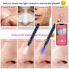 Blackhead Remover Tools with Camera Visible Pore Cleaner Waterproof Acne Comedone Whitehead Extractor Kit for iPhone/Android view 3