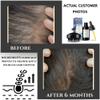 USDA Organic Hair Oil Treatment for Intense Nourishment, Dry Scalp Relief, and Hair Growth Promotion - Silicone Head Massager for Relaxation and Exfoliation view 2