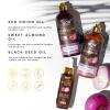 WOW Skin Science Onion Black Seed Oil Shampoo & Conditioner Treatment Set with Oil for Strong, Soft & Shine Hair for All, Dry, Damaged Hair Types, Sulfate, Paraben, Silicone Free view 2