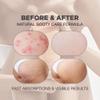 Butt Scrub Wash and Butt Acne & Ingrown Hair Treatment Serum | AHA & BHA Butt Acne and Ingrown Hair Treatment For Bikini Area | Get rid of Butt Acne, Ingrown Hair, Back Acne, Strawberry Legs view 3