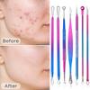 Pimple Popper Tool Kit - 10Pcs Blackhead Remover Comedone Extractor Tool Kit with Metal Case for Quick and Easy Removal of Pimples, Blackheads, Zit Removing, Forehead, Facial and Nose (Multicolor) view 4