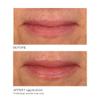 NassifMD Vanilla Lip Sugar Scrub, Moisturizer and Exfoliator, Vanilla Lip Scrub, Exfoliating Lip Scrub with Jojoba Oil, 0.50 oz view 3