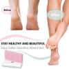 ZMOI Glass Pumice Stone Callus Remover for Feet, Elbows, Hands, and Knees, Spain Made - 2 in 1 Pedicure Exfoliator and Scrubber for Rough, Hard Skin (Pink Color) view 4