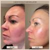 EvenSkyn Phoenix  Light-Powered 4-Roller Face & Neck Sculpting Tool | Daily Microcurrent Skincare Bar for Gentle Massage, Relaxation & Facial Contouring view 3