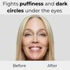 M. Asam MAGIC CARE Perfect Eye Serum - eye serum with 360 tightening effect, effectively fights puffiness & dark circles, tightens the eyelid, eye care with hyaluronic acid complex, 0.84 Fl Oz view 3