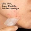 Epielle Over-Zit XL Acne Clear Patches | Ultimate Hydrocolloid Solution | 14 Extra-Large Pimple and Blemish Patches view 3