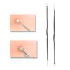Sihuuu Blackhead Remover Pimple Extractor Stainless Steel Pimple Popper Acne Extractions Tool (D,1 Pack) view 4