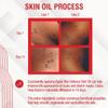 Basix Skin Defence Clear Skin Tissue Oil  Helps Improve the Appearance of Scars, Stretch Marks & Uneven Skin Tone with Tamanu, Argan, Grapeseed, Jojoba, Rosehip, Calendula & Geranium Oils view 4