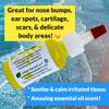 Urban ReLeaf Piercing Bump Relief with Easy Dropper ! Soothe, Shrink, Fade Keloids & Bumps. Made Fresh in USA! Natural Aftercare Treatment. Ears, Nose, Nipples, Facial, Body Areas. Gentle Soothing view 4