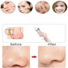 ELORES Cleansing Instrument, Waterproof Electric Face Cleansing Brush Device for Deep Cleaning| Suction Black Spot,Rechargeable Silicone Skin Wash Machine view 3