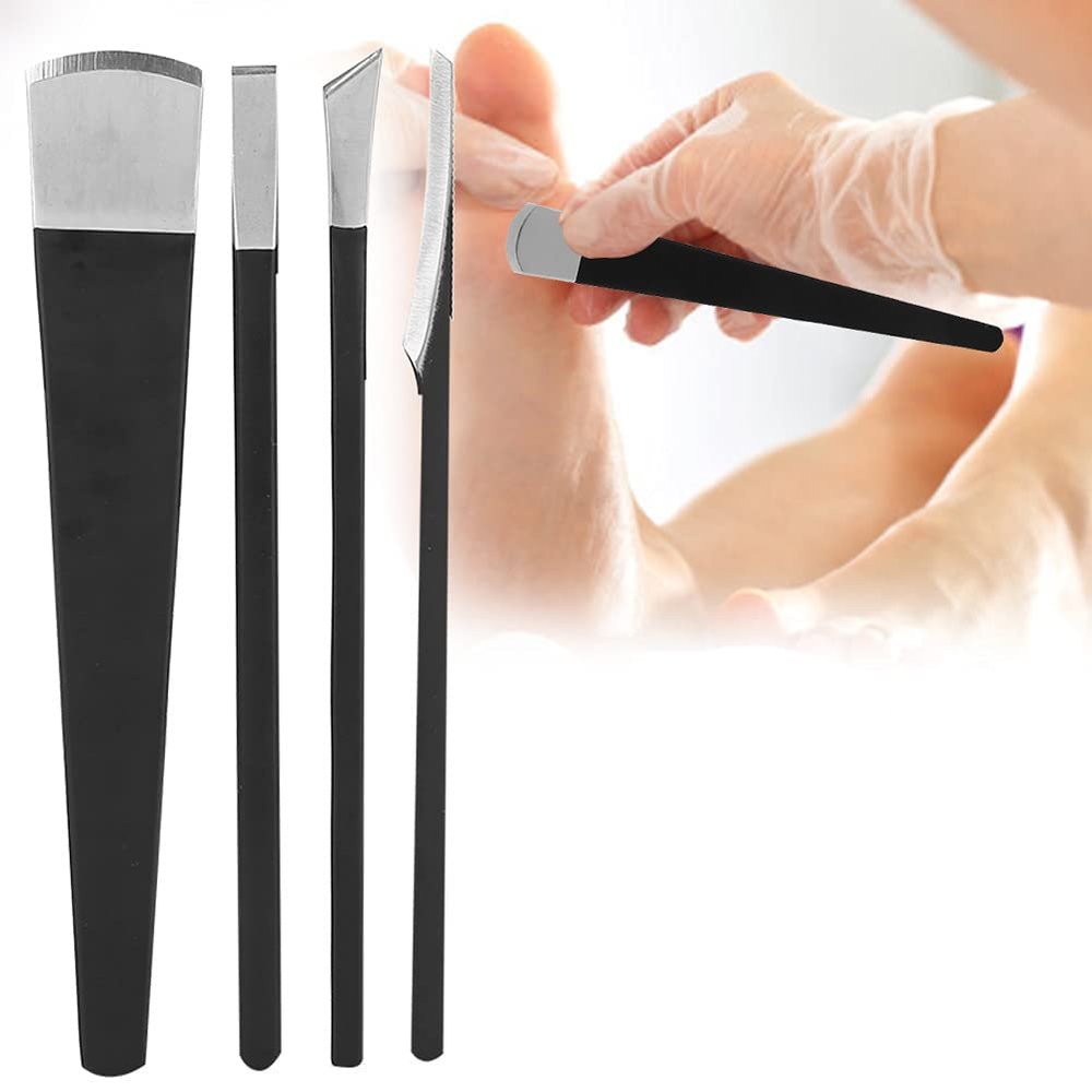 Watris Veiyi 4PCS Pedicure Knife Set, Ingrown Toenail Removal Kit, Pedicure Callus Shaver Tools, Professional Foot Scraper, Steel Foot Care for Dead Skin Corn Foot Remover Foot File Rasp (6.3in)