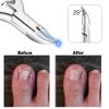 Moosec Toenail Clippers for Ingrown and Thick Toenails with Safety Lock Comfortble Wooden Handle Sturdy Toenail Clippers view 3