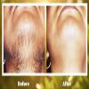 Cuty The Healthier Life With Beauty Ponnatharam Hair Removal Powder (50 Gm) view 3