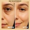 Under Eye Patches with Caffeine, Collagen & Niacinamide (30 Pairs)  Hydrating Eye Mask for Puffy Eyes, Dark Circles, Wrinkles, and Fine Lines  Reduces Eye Bags  formulated in North America view 4