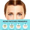 PICcircuit Pimple Patches for Face, Hydrocolloid Acne Patches, Invisible Zit Patches for Face, Acne Spot Treatment Patch Cystic Blemish Patches Zit Stickers for all Skin Colors (360 Counts) view 2